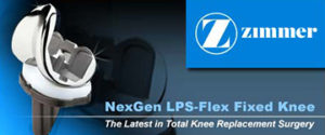 zimmer-knee-replacement-lawsuits-nebraska