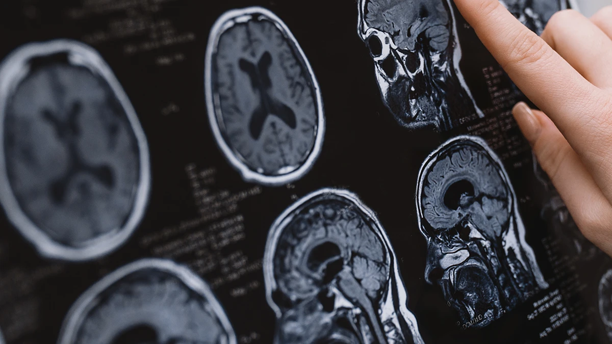 A doctor reviews a patient's MRI scan for brain trauma